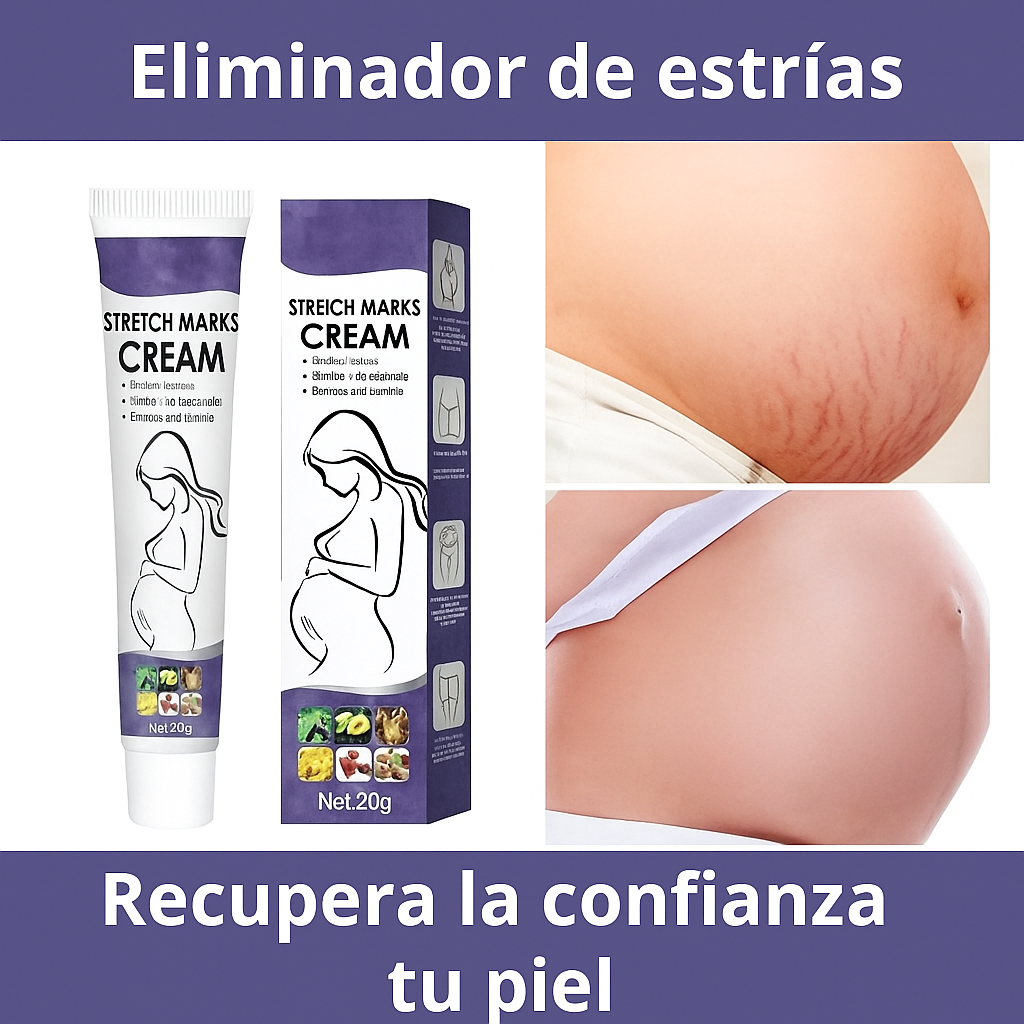 SOUTH MOON - ¡Eliminador de Estrías Efecto Rápido!