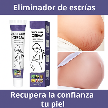 SOUTH MOON  -  ¡Eliminador de Estrías Efecto Rápido!